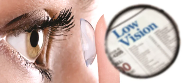 Low vision aids and specialized contact lenses for sight correction