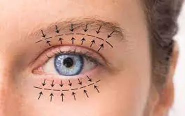 Eye care treatment procedure in medical setting