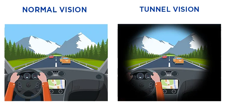 Glaucoma patient experiencing vision impairment and visual field changes